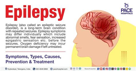 remote symptomatic epilepsy definition|symptomatic epilepsy treatment.